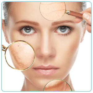 skin rejuvenation areas treated